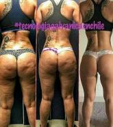 tratamientos galvanicos